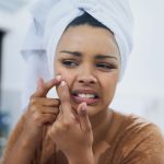 pimple popping